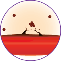 growth