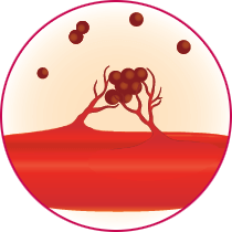 vessel growth